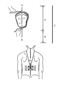 Two diagrams showing a jôsetsu-hô technique. The first shows string wrapped around the feet to get measurements A and B, which combine into C. The second shows how measurement C is used around the neck to locate point P1 on the back midline. R1 and R2 are marked 1 cun lateral to P1; P2 and P3 are 1 cun superior, and P4 and P5 are 1 cun inferior.