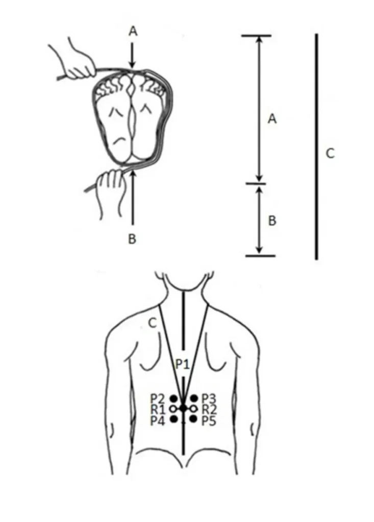 Two diagrams showing a jôsetsu-hô technique. The first shows string wrapped around the feet to get measurements A and B, which combine into C. The second shows how measurement C is used around the neck to locate point P1 on the back midline. R1 and R2 are marked 1 cun lateral to P1; P2 and P3 are 1 cun superior, and P4 and P5 are 1 cun inferior.